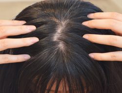 Kenapa Rambut Beruban Lebih Dini? Ini Sebabnya dan Cara Pencegahanya, Simak!