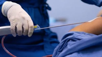 Kematian Selebgram Ella Nanda, Polisi Sita Alat Sedot Lemak di Klinik Kecantikan Beji Depok